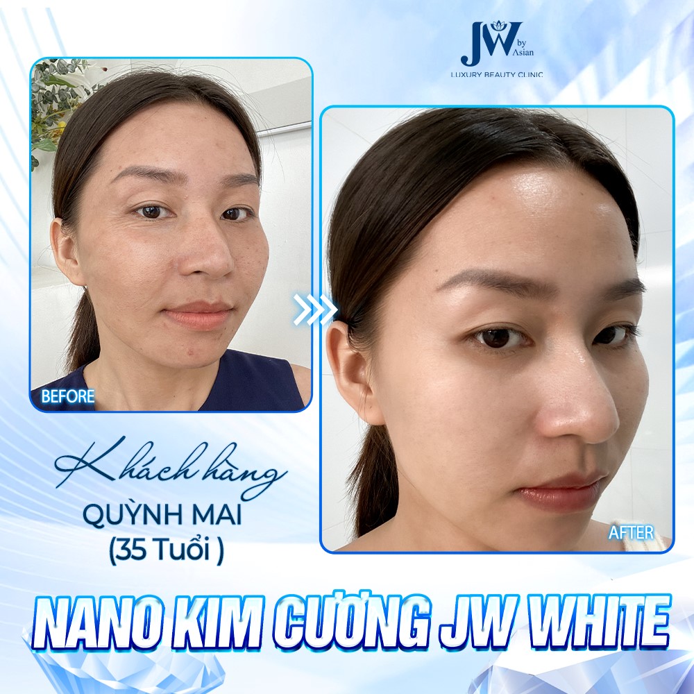 Công nghệ Chỉ Nano JW WHITE