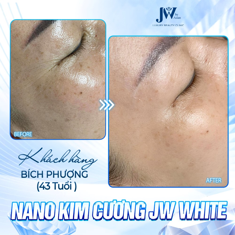 Công nghệ Chỉ Nano JW WHITE