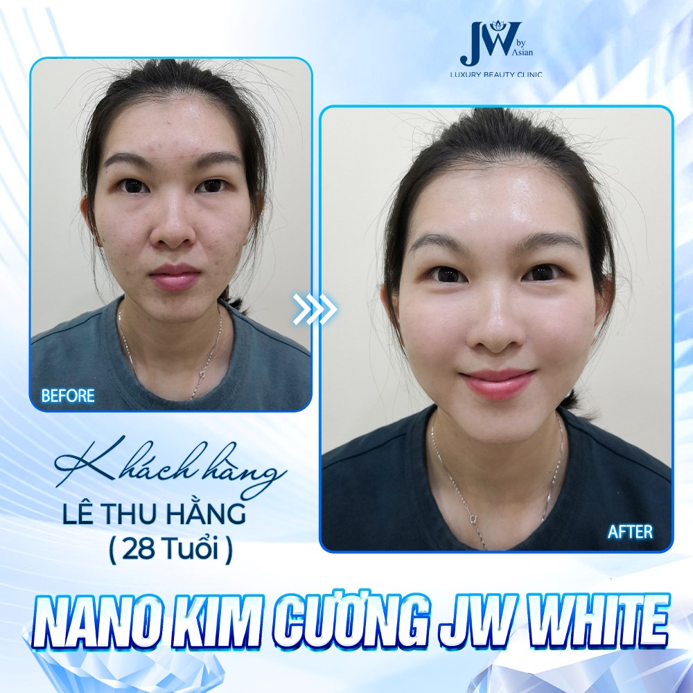 Công nghệ Chỉ Nano JW WHITE