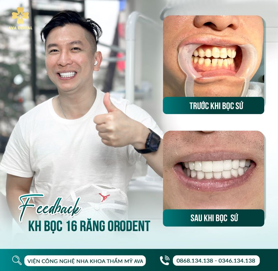 AVA Dental