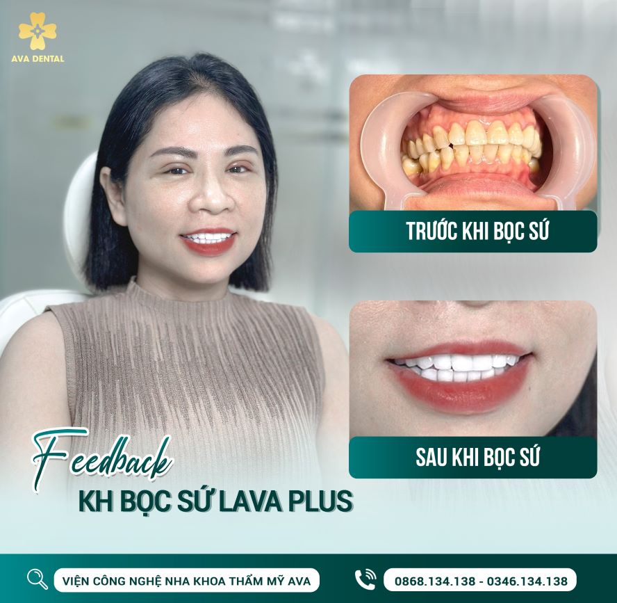 AVA Dental