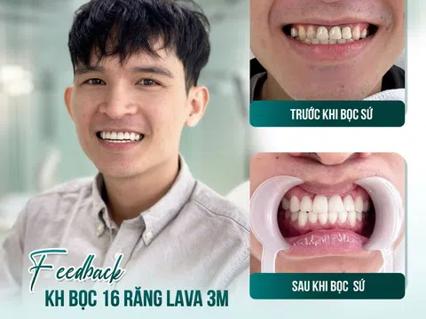 Bác sĩ tư vấn dáng răng sứ phong thủy: Thay đổi vận mệnh - tài lộc